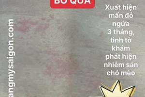 Ngứa Dai Dẳng Suốt Ngày: Cảnh Báo Nhiễm Ký Sinh Trùng Mà Nhiều Người Không Ngờ Tới