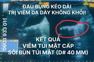 Đau Bụng Dữ Dội Kéo Dài, Không Phải Chỉ Do Viêm Dạ Dày