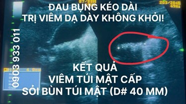 Đau Bụng Dữ Dội Kéo Dài, Không Phải Chỉ Do Viêm Dạ Dày